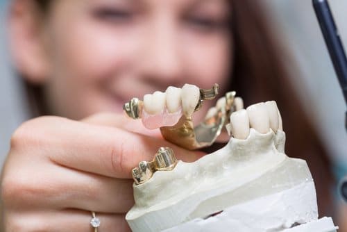 Prothèse dentaire - soins dentaires - Cliniques dentaires Bailli et Verbist à Bruxelles